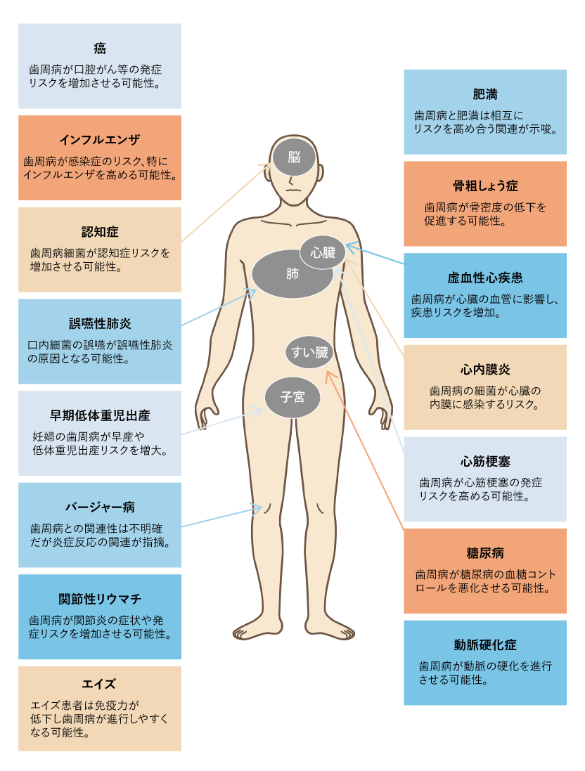 歯周病と全身疾患の関係
